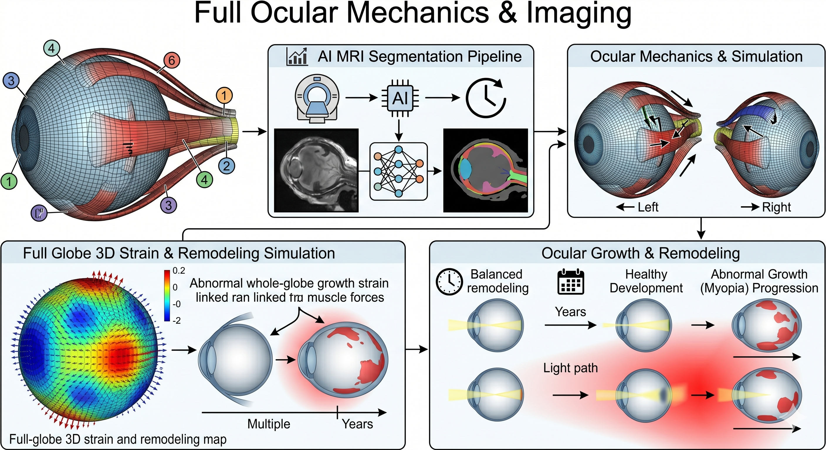 Ocular mechanics